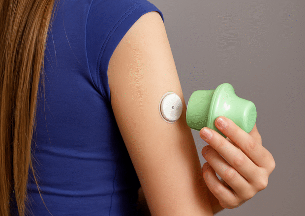 Attēls parāda Linx CGM ierīces uzstādīšanu