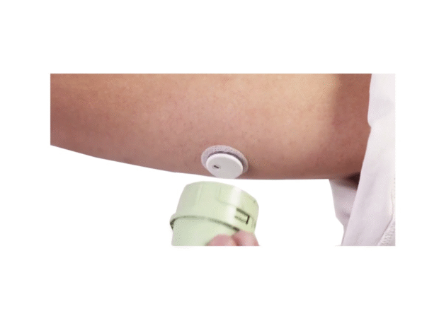 Cukura diabēta pazīmes: kas liecina par augstu glikozes līmeni asinīs? 3 CGM ierīces uzstādīšana